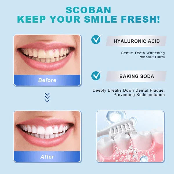 Scoban - Teeth Whitening (Original) - Arazalabllc