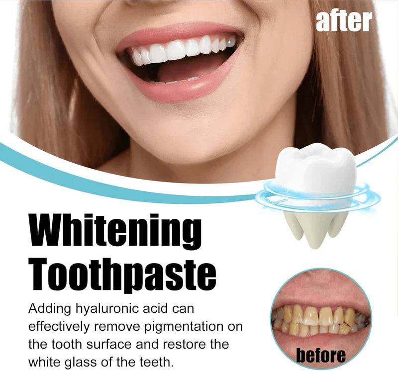 Scoban - Teeth Whitening (Original) - Arazalabllc